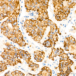 LYPLA1 Recombinant Rabbit Monoclonal Antibody (3R1A2)