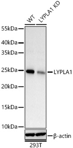 LYPLA1 Antibody in Western Blot (WB)