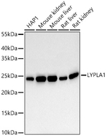 LYPLA1 Antibody in Western Blot (WB)