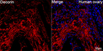 Decorin Antibody in Immunohistochemistry (Paraffin) (IHC (P))