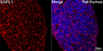 SGPL1 Antibody in Immunohistochemistry (Paraffin) (IHC (P))
