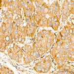 SGPL1 Antibody in Immunohistochemistry (Paraffin) (IHC (P))
