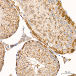SGPL1 Antibody in Immunohistochemistry (Paraffin) (IHC (P))