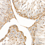 SGPL1 Antibody in Immunohistochemistry (Paraffin) (IHC (P))