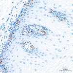 RAD51 Antibody in Immunohistochemistry (Paraffin) (IHC (P))