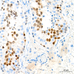RAD51 Antibody in Immunohistochemistry (Paraffin) (IHC (P))