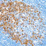 RAD51 Antibody in Immunohistochemistry (Paraffin) (IHC (P))