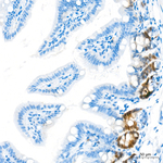 RAD51 Antibody in Immunohistochemistry (Paraffin) (IHC (P))