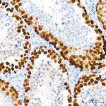 RAD51 Antibody in Immunohistochemistry (Paraffin) (IHC (P))