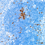 RAD51 Antibody in Immunohistochemistry (Paraffin) (IHC (P))