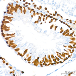 RAD51 Antibody in Immunohistochemistry (Paraffin) (IHC (P))