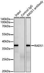 RAD51 Antibody in Immunoprecipitation (IP)