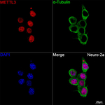 METTL3 Recombinant Rabbit Monoclonal Antibody (6G8P7)