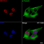 METTL3 Antibody in Immunocytochemistry (ICC/IF)