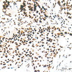 METTL3 Antibody in Immunohistochemistry (Paraffin) (IHC (P))