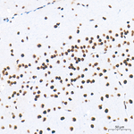 METTL3 Antibody in Immunohistochemistry (Paraffin) (IHC (P))
