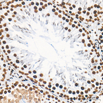 METTL3 Antibody in Immunohistochemistry (Paraffin) (IHC (P))