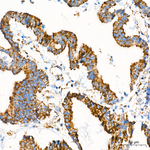 ETFDH Antibody in Immunohistochemistry (Paraffin) (IHC (P))
