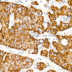 ETFDH Antibody in Immunohistochemistry (Paraffin) (IHC (P))