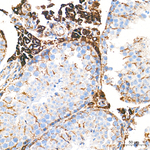 ETFDH Antibody in Immunohistochemistry (Paraffin) (IHC (P))