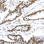 SMARCAD1 Antibody in Immunohistochemistry (Paraffin) (IHC (P))