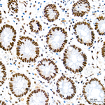 SMARCAD1 Antibody in Immunohistochemistry (Paraffin) (IHC (P))