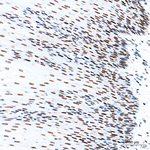 SMARCAD1 Antibody in Immunohistochemistry (Paraffin) (IHC (P))