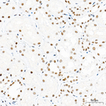 SMARCAD1 Antibody in Immunohistochemistry (Paraffin) (IHC (P))
