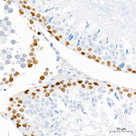 SMARCAD1 Antibody in Immunohistochemistry (Paraffin) (IHC (P))