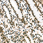 H4K8ac Antibody in Immunohistochemistry (Paraffin) (IHC (P))