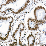 H4K8ac Recombinant Rabbit Monoclonal Antibody (2X5S10)