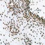 H4K8ac Antibody in Immunohistochemistry (Paraffin) (IHC (P))