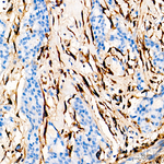 COL1A1 Antibody in Immunohistochemistry (Paraffin) (IHC (P))