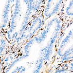 COL1A1 Antibody in Immunohistochemistry (Paraffin) (IHC (P))
