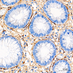 COL1A1 Antibody in Immunohistochemistry (Paraffin) (IHC (P))