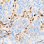 COL1A1 Antibody in Immunohistochemistry (Paraffin) (IHC (P))