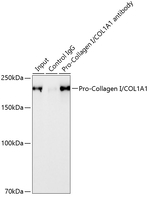 COL1A1 Antibody in Immunoprecipitation (IP)