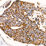 MRPL21 Antibody in Immunohistochemistry (Paraffin) (IHC (P))