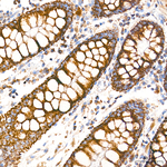 MRPL21 Antibody in Immunohistochemistry (Paraffin) (IHC (P))