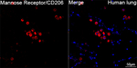 CD206 Recombinant Rabbit Monoclonal Antibody (8Z3J10)