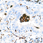 CD206 Antibody in Immunohistochemistry (Paraffin) (IHC (P))