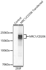 CD206 Antibody in Western Blot (WB)