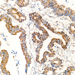 XPNPEP3 Recombinant Rabbit Monoclonal Antibody (5Y2T7)