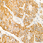 XPNPEP3 Antibody in Immunohistochemistry (Paraffin) (IHC (P))