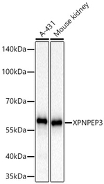 XPNPEP3 Antibody in Western Blot (WB)