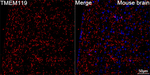 TMEM119 Antibody in Immunohistochemistry (Paraffin) (IHC (P))