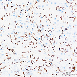 TMEM119 Antibody in Immunohistochemistry (Paraffin) (IHC (P))
