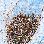 TMEM119 Antibody in Immunohistochemistry (Paraffin) (IHC (P))