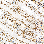 Transketolase Antibody in Immunohistochemistry (Paraffin) (IHC (P))