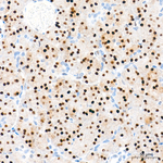 Transketolase Antibody in Immunohistochemistry (Paraffin) (IHC (P))